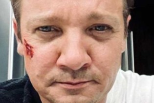 Após acidente, Jeremy Renner publica primeira foto no Instagram e envia mensagem aos fãs